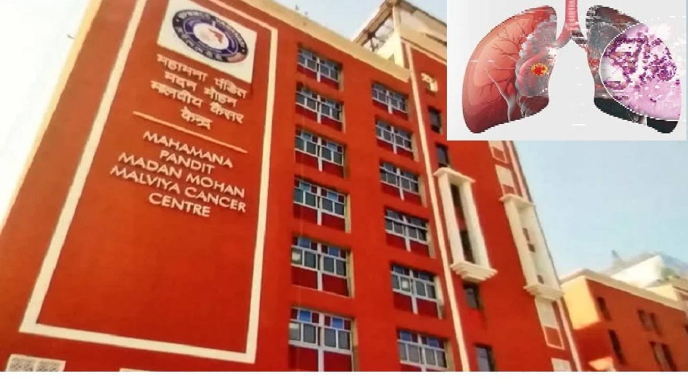 फेफड़े के कैंसर की जांच को अब नहीं करना होगा महानगरों का रुख