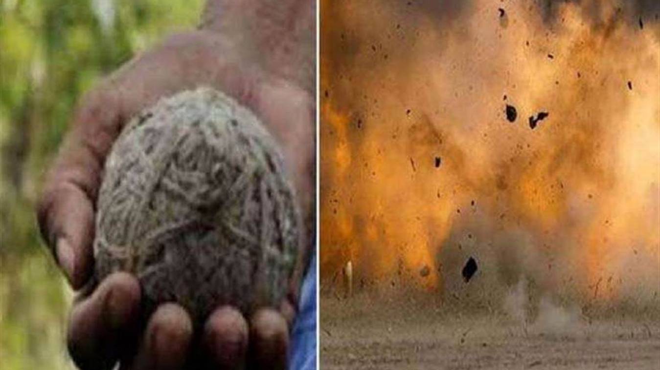 सड़क किनारे खेलते समय बच्चों को मिला बम,पटाखा समझ फोड़ दिया, चार घायल 