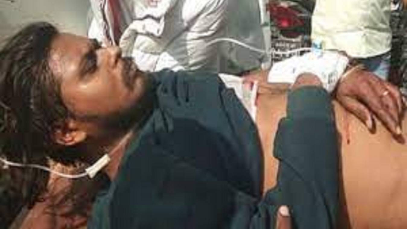 जौनपुर में बाइक सवार बदमाशों ने दिनदहाड़े युवक को तड़तड़ाई गोली, हालत गंभीर, जांच जारी