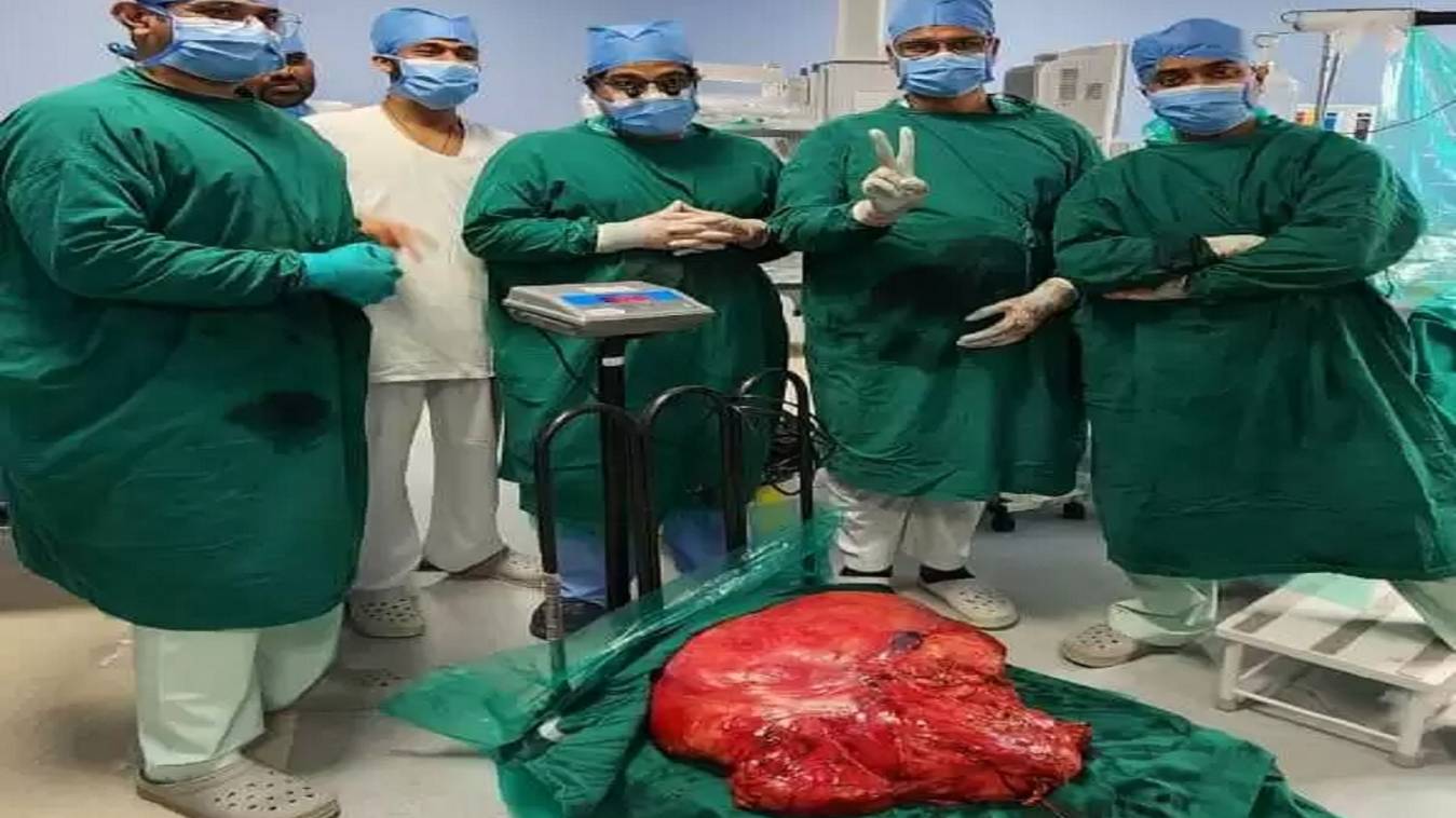 डॉक्टरों ने पेट से निकाला 30 किलो का ट्यूमर, मरीज का चलना-फिरना हो गया था दुश्वार
