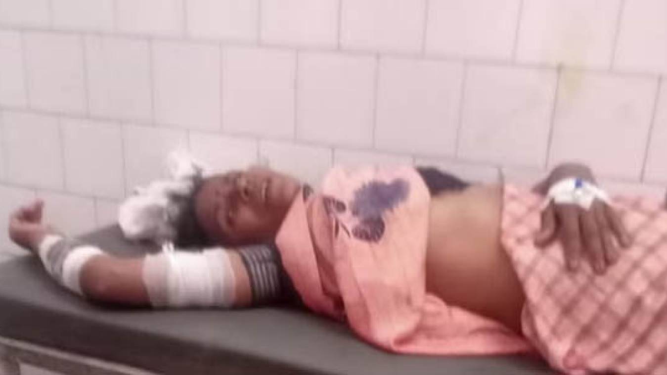 नाली निर्माण के दौरान लापरवाही पड़ी भारी, गड्ढे में गिरी महिला