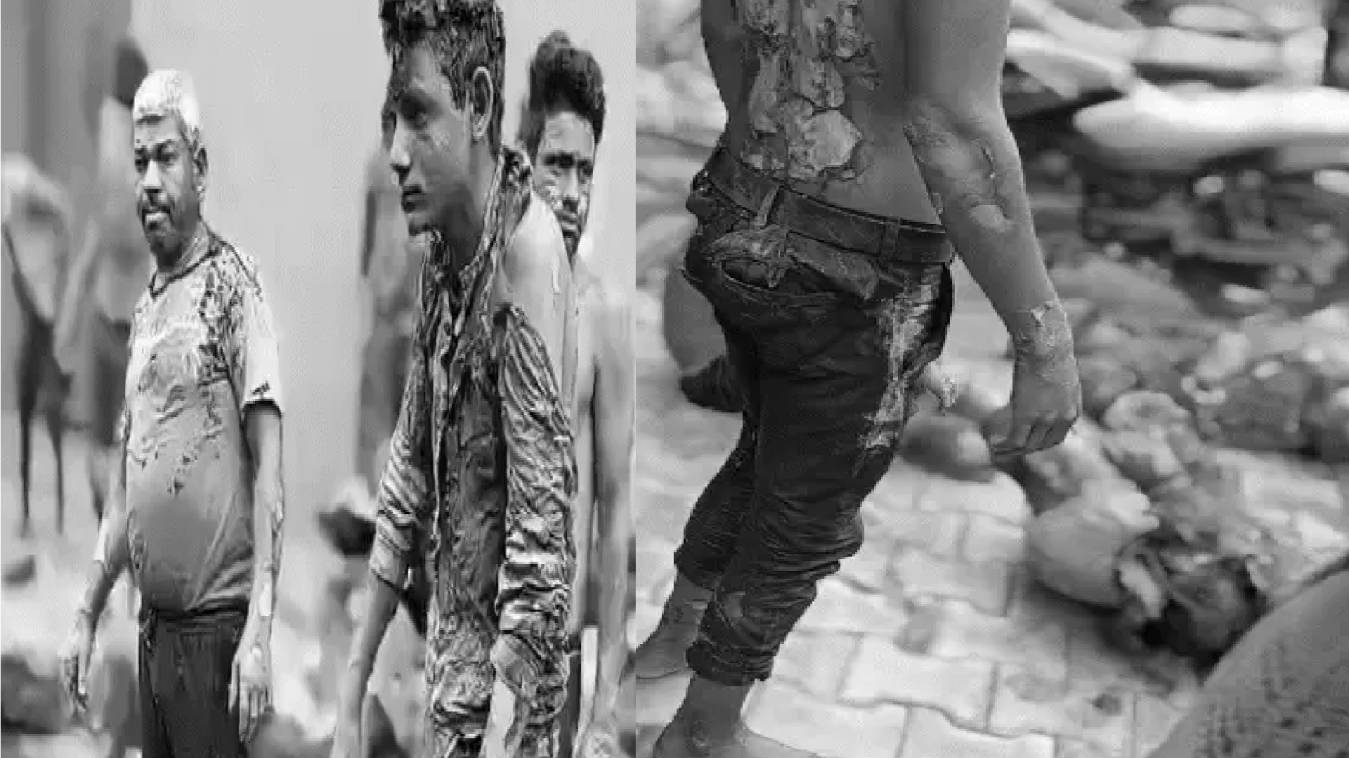 आगरा में बड़ा हादसा: बेकरी का ओवन फटने से 13 कर्मचारी झुलसे, सड़क पर 1 घंटे तक तड़पते रहे पीड़ित और वीडियो बनाते रहे पुलिसकर्मी