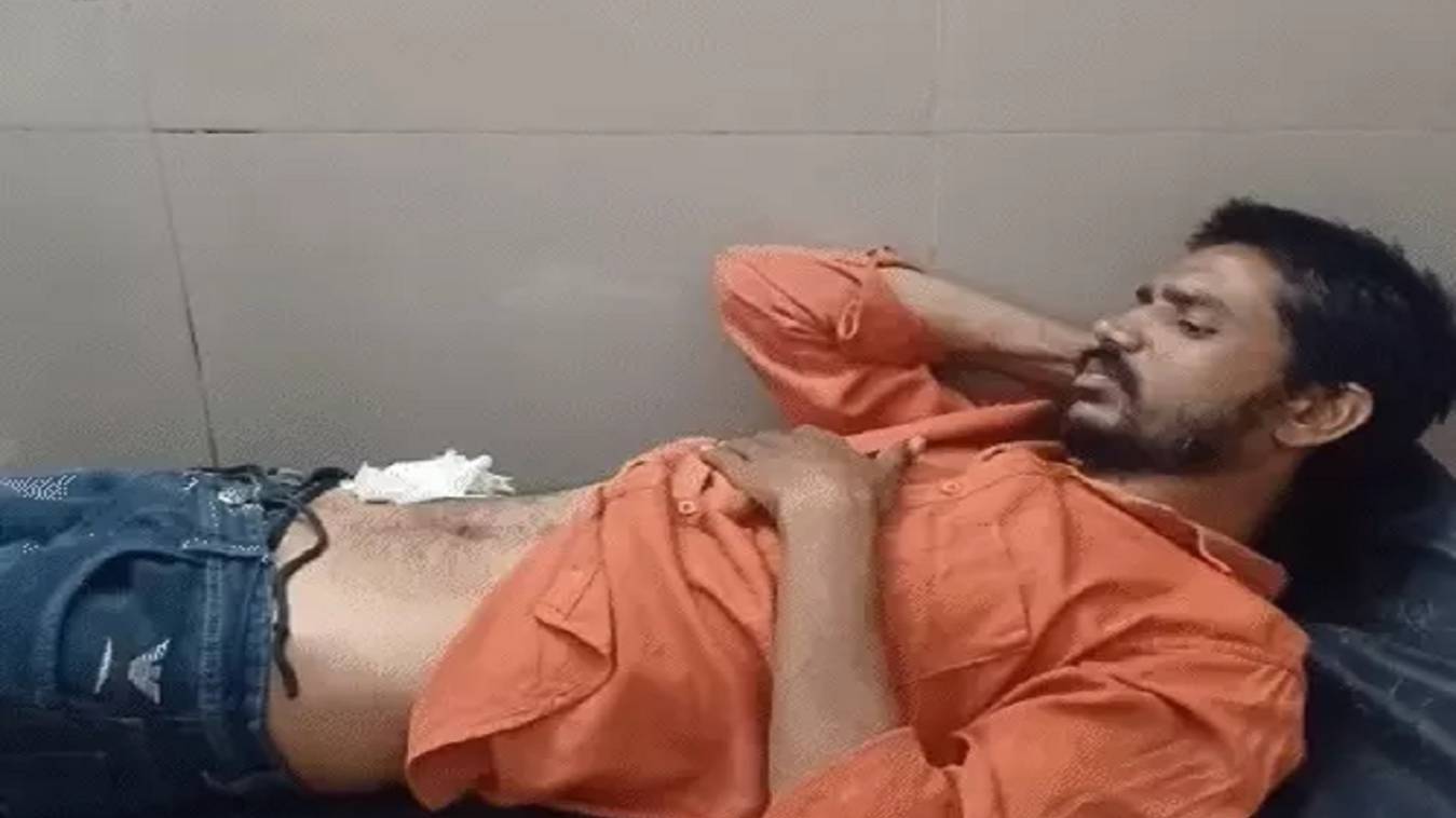 मथुरा में पेट दर्द से परेशान युवक ने यूट्यूब देखकर खुद ही कर ल‍िया अपना ऑपरेशन, फिर जो हुआ...