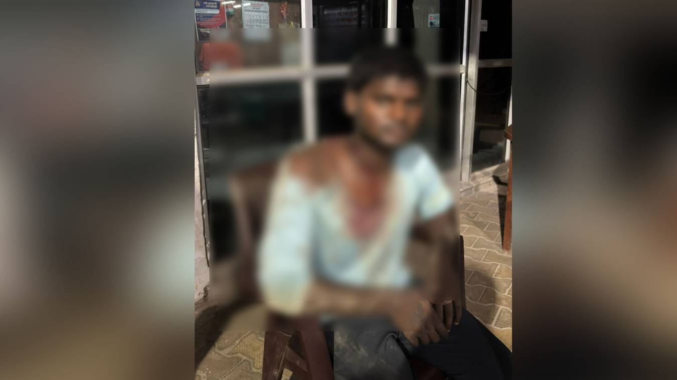 वाराणसी में प्रेम संबंध के शक में युवक पर कुल्हाड़ी से किया वार, हालत गंभीर,  FIR