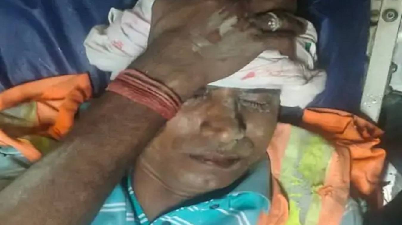 वाराणसी: सड़क हादसे में नगर निगम कर्मचारी गंभीर रूप से घायल, ड्यूटी से लौटते समय अज्ञात वाहन ने मारी टक्कर