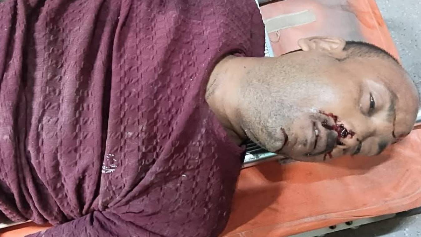 रिंग रोड पर हादसा: मजदूर की सड़क दुर्घटना में मौत, परिजनों ने किया जाम का प्रयास