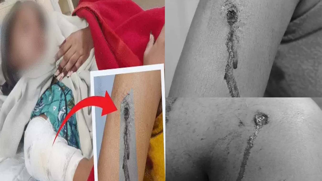 लखनऊ में सिरफिरे प्रेमी ने आधी रात घर में घुसकर युवती को मारी गोली, हालत गंभीर