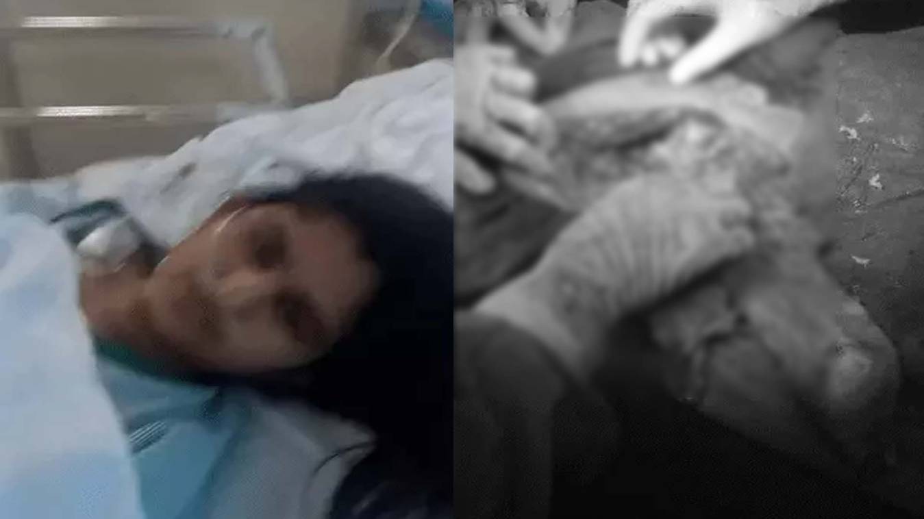 ग्रेटर नोएडा में मेडिकल लापरवाही: ऑपरेशन के डेढ़ साल बाद महिला के पेट से निकला आधा मीटर कपड़ा, कोर्ट के आदेश पर 6 पर FIR