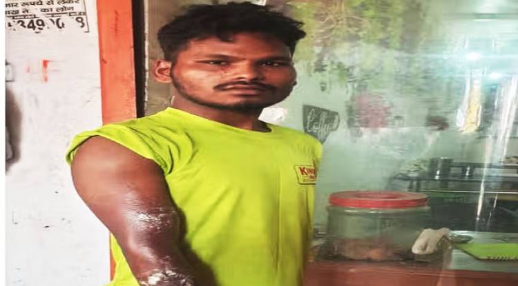 चाय-समोसा का पैसा मांगने पर...फेंक दिया खौलता तेल, झुलसा; केस दर्ज