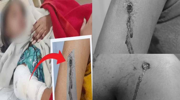 लखनऊ में सिरफिरे प्रेमी ने आधी रात घर में घुसकर युवती को मारी गोली, हालत गंभीर