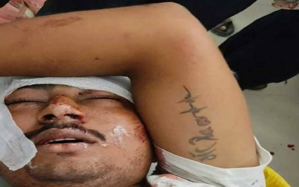 वाराणसी में मिट्टी कारोबारी के सिर में मारी गोली, पुलिस तीनों आरोपियों की तलाश जुटी