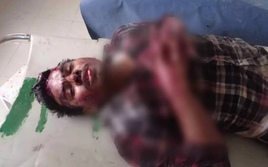 इलाज को जा रहे मानसिक युवक गाड़ी का दरवाजा खोलकर गंगा नदी में कूदा