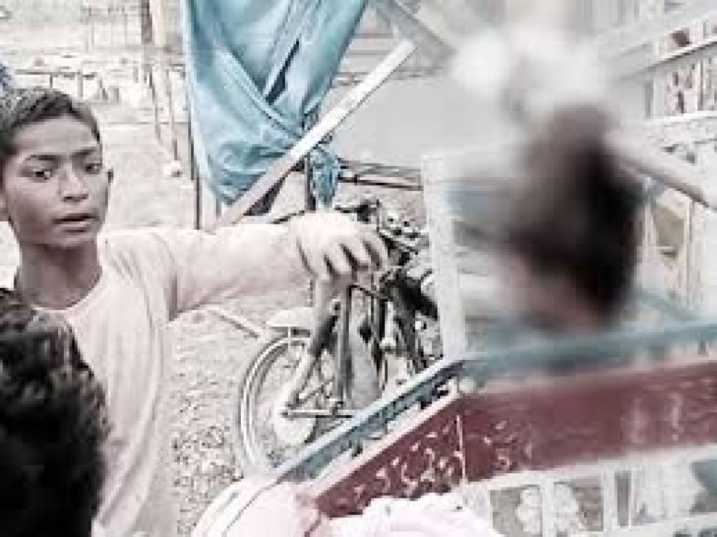 झूले में फंसी चोटी... चमड़ी के साथ उखड़े किशोरी के बाल
