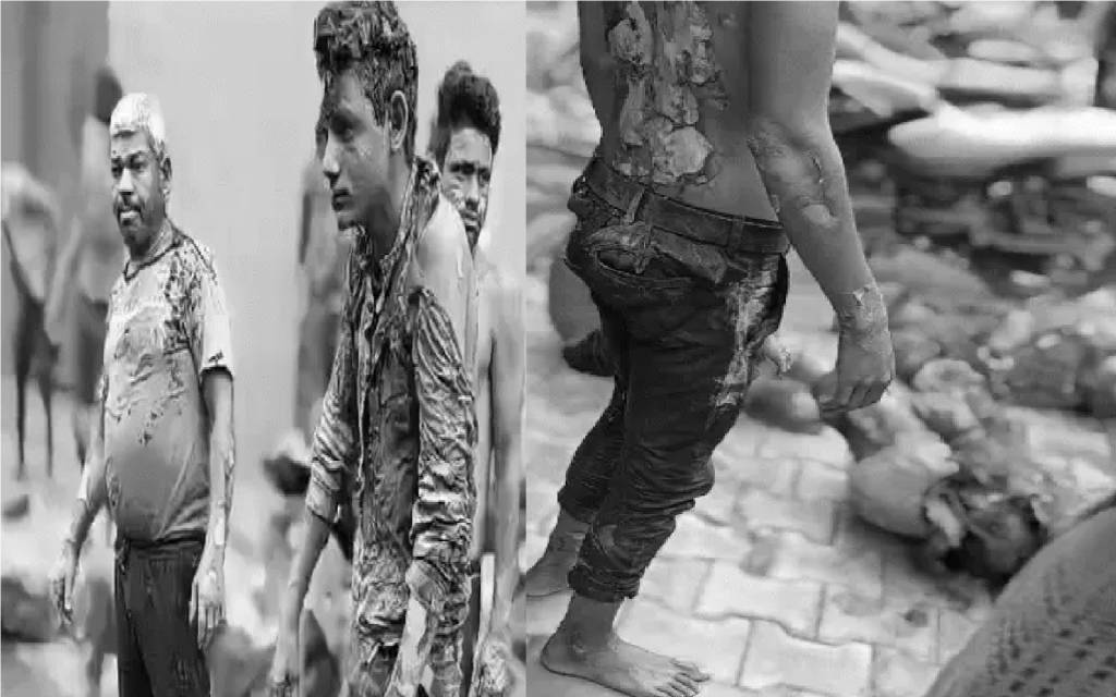 आगरा में बड़ा हादसा: बेकरी का ओवन फटने से 13 कर्मचारी झुलसे, सड़क पर 1 घंटे तक तड़पते रहे पीड़ित और वीडियो बनाते रहे पुलिसकर्मी