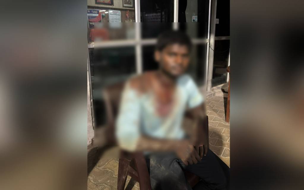 वाराणसी में प्रेम संबंध के शक में युवक पर कुल्हाड़ी से किया वार, हालत गंभीर, FIR