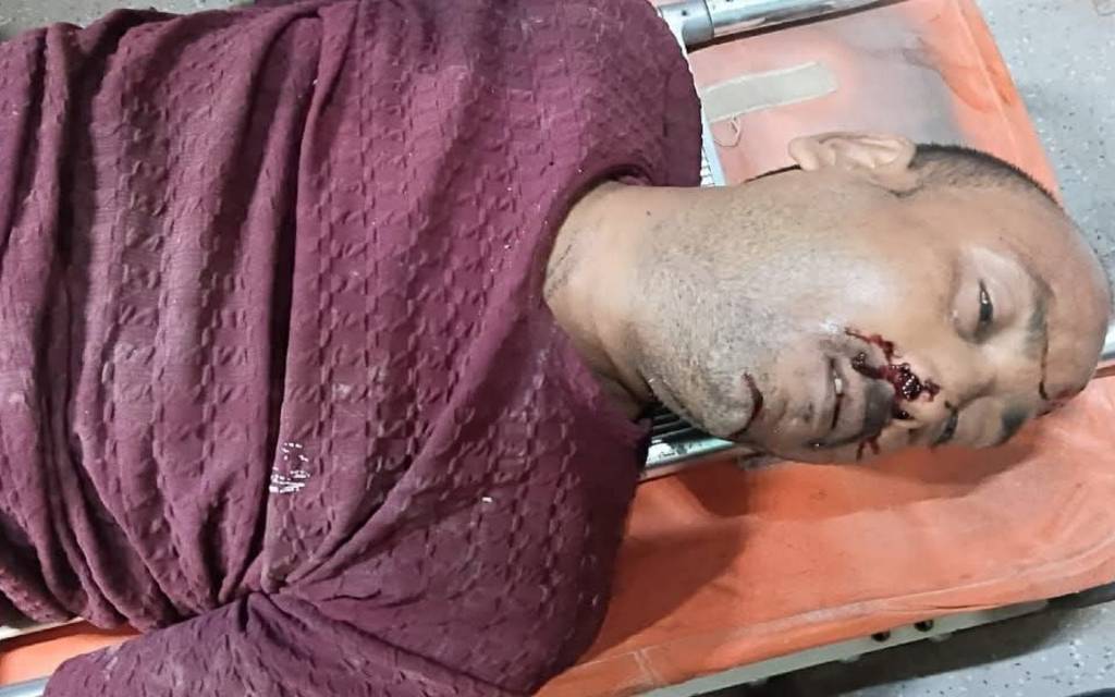 रिंग रोड पर हादसा: मजदूर की सड़क दुर्घटना में मौत, परिजनों ने किया जाम का प्रयास