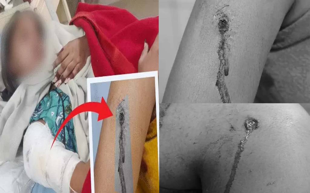 लखनऊ में सिरफिरे प्रेमी ने आधी रात घर में घुसकर युवती को मारी गोली, हालत गंभीर