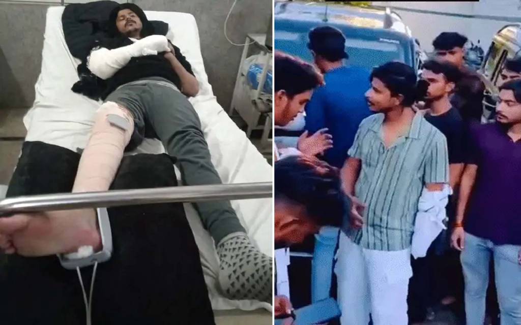 20 लाख की फिरौती में अपहरण, पुलिस से बचने में छत से कूदा बदमाश; अस्पताल में भर्ती