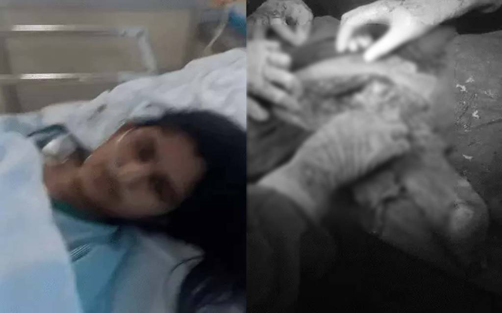 ग्रेटर नोएडा में मेडिकल लापरवाही: ऑपरेशन के डेढ़ साल बाद महिला के पेट से निकला आधा मीटर कपड़ा, कोर्ट के आदेश पर 6 पर FIR